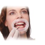 RET P/ESTETICA OPTRA GATE - Imagen 2