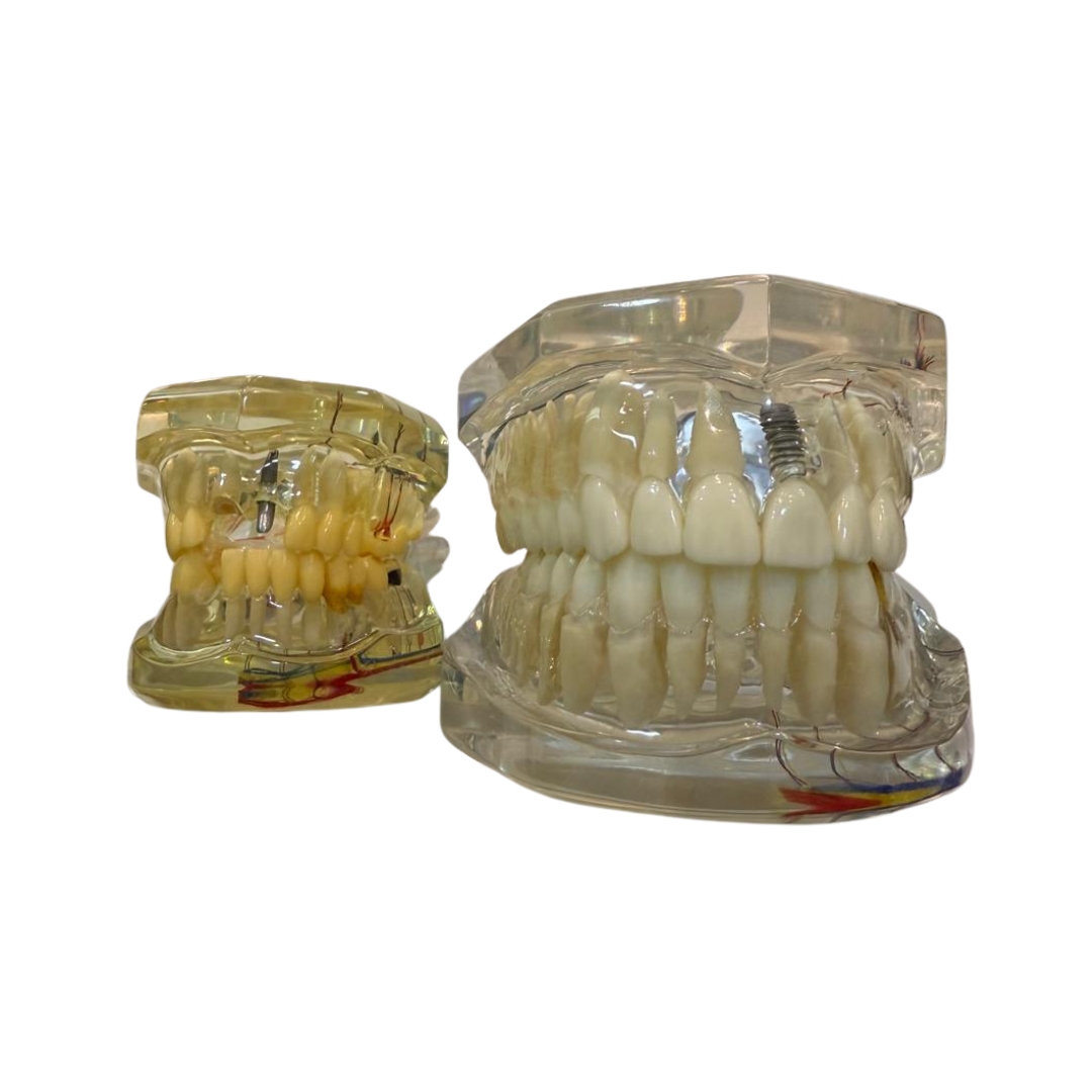 roic15 MACROMODELO RI 100 - Imagen 1