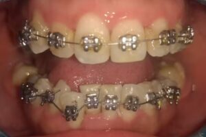 Allevato Adri&aacute;n