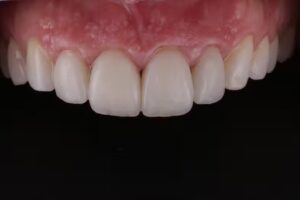 Alvarez – Cañupan Odontología