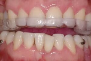 Angelucci Vazquez Odontologia Estetica Odontologo Implantes Carillas Ortodoncista en Nu&ntilde;ez Capital Federal