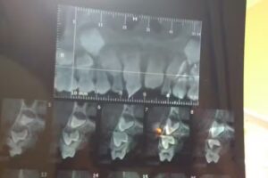 Bodini Gabriela – Odontologa- Especialista en Niños- Atencion a adultos.