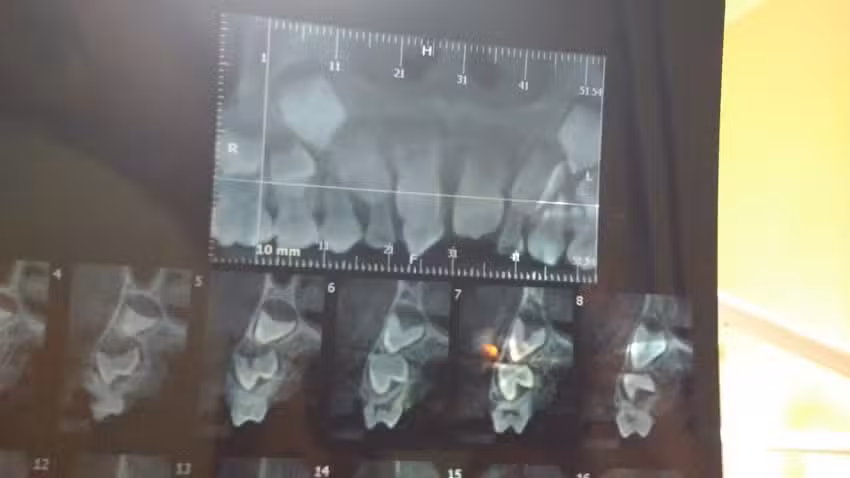 Bodini Gabriela &ndash; Odontologa- Especialista en Ni&ntilde;os- Atencion a adultos.