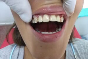 Brasca&Iba&ntilde;ez Odontolog&iacute;a