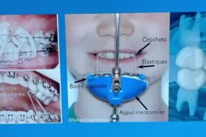 CityDent &ndash; Cl&iacute;nica Odontologica. Ortodoncia e Implantes