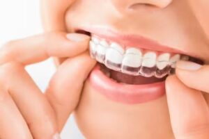 Clinica Face Mendoza . Cirugia Ortognatica.Ortodoncia y Ortopedia de Maxilares