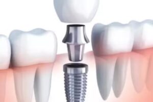 CONSULTORIO DENTAL Dra Dieguez Cristina