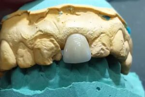 Consultorio Odont. Dr Medina Oscar