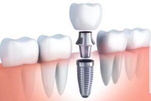 Consultorio odontoligico Vitaldent