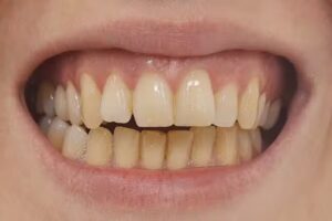 Consultorio Odontol&oacute;gico Bermudez