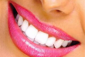 Consultorio Odontologico Dr. Luis Alfredo Corso/Dr. Elsa Laiker