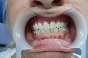 Consultorio Odontol&oacute;gico Dr. Rafael Franco Mu&ntilde;oz