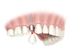 Consultorio Odontologico Dra. Maria Ferreyra