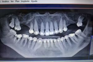 Consultorio Odontologico Dra. Mereles Doris
