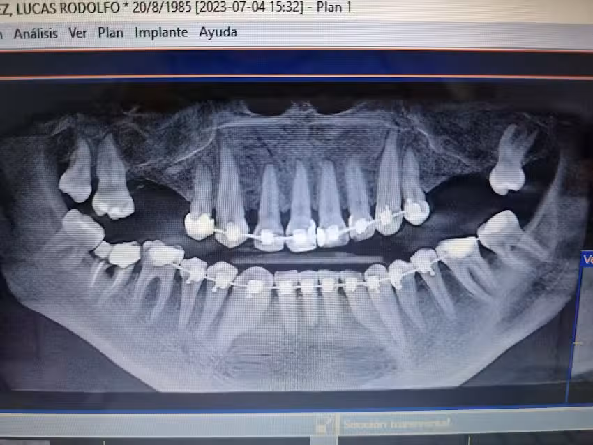 Consultorio Odontologico Dra. Mereles Doris