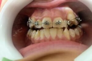 Consultorio odontológico Dra Romero Débora