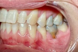 Consultorio Odontologico Hern&aacute;n Santa Cruz