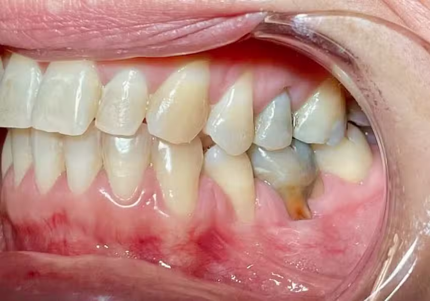 Consultorio Odontologico Hern&aacute;n Santa Cruz