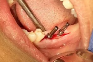 CONSULTORIO ODONTOLOGICO INTEGRAL Dr BELAZQUEZ wilfrido