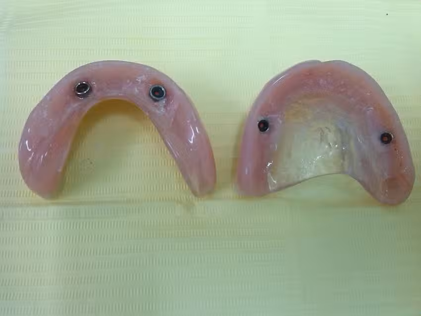 Consultorios Implant&oacute;l&oacute;gicos Dr. Germ&aacute;n Assanelli