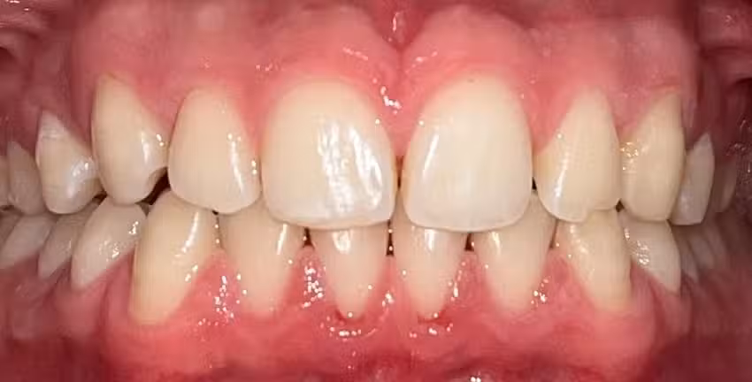 Daniel Huanambal Gim&eacute;nez, Cirujano oral y maxilofacial