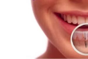 Dental Assistance Ⓡ