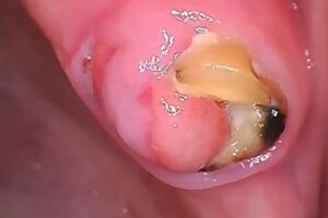 Dr. Bruno, Federico G.