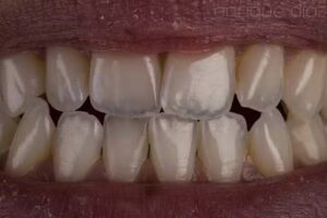 Dr Hern&aacute;n Bollini