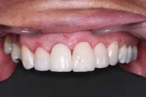 Dr. Matias Anghileri &ndash; Cl&iacute;nica Odontol&oacute;gica