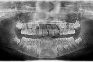 Dra. Maria Pia Vela Rasgido. Ortodoncia y Odontologia General
