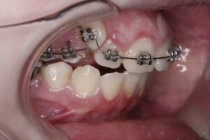 Eliana Jankowski Odont&oacute;loga