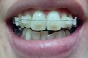 Estetica Dental Dra Hebe Gandolfi