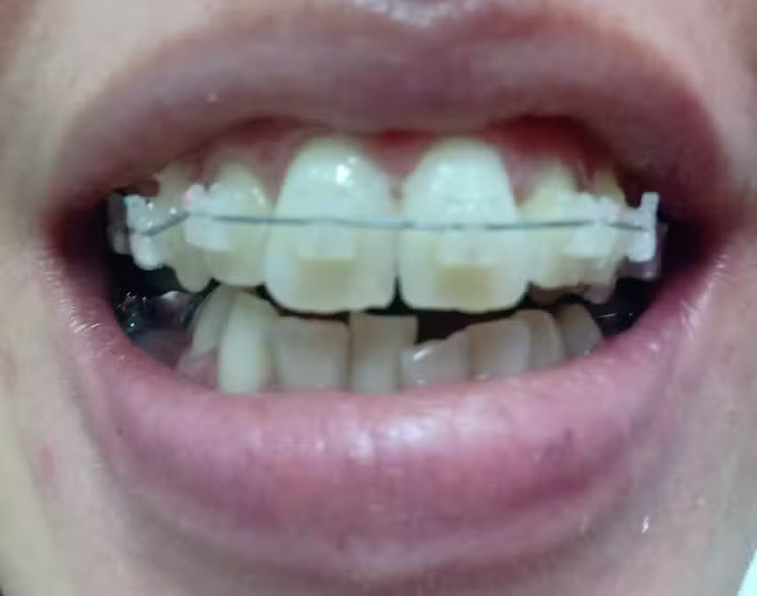 Estetica Dental Dra Hebe Gandolfi