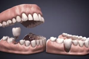 Imagen Dental Urkupi&ntilde;a