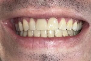 Juan I Molina Odontolog&iacute;a