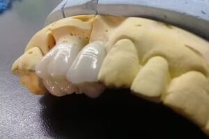 Laboratorio Dental Laforza