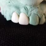 Mec&aacute;nica dental