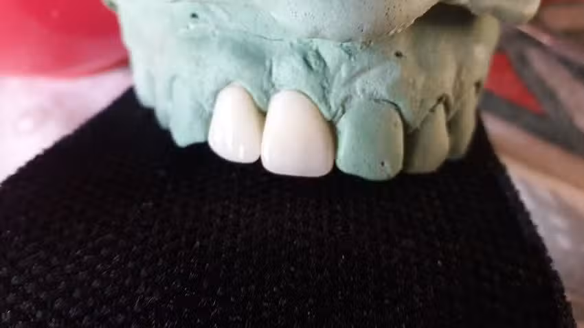 Mec&aacute;nica dental