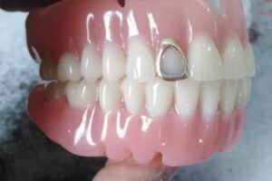 Mecanica dental rossana