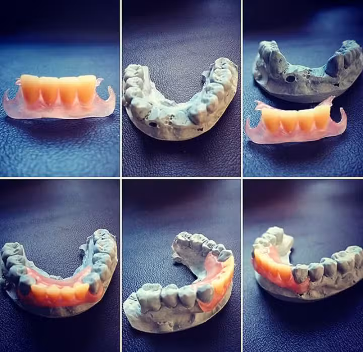 Mec&aacute;nico Dental Protesis Flex