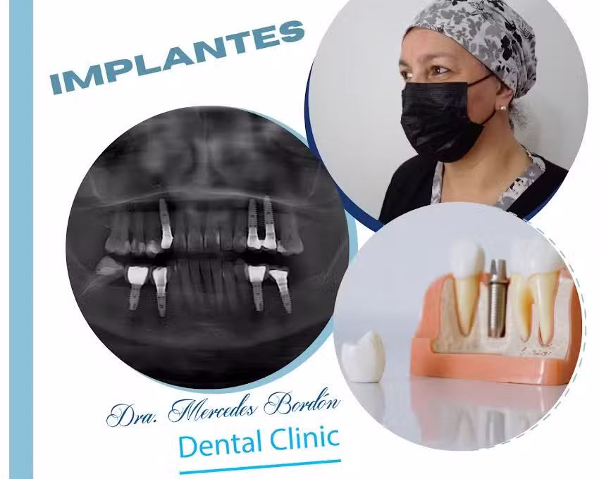 Mercedes Bord&oacute;n Dental Clinic &ndash; Odontolog&iacute;a General