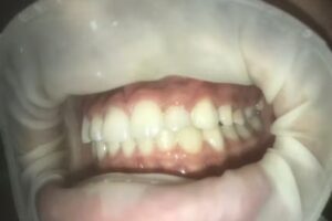 Noelia Acosta-Ortodoncia Morteros