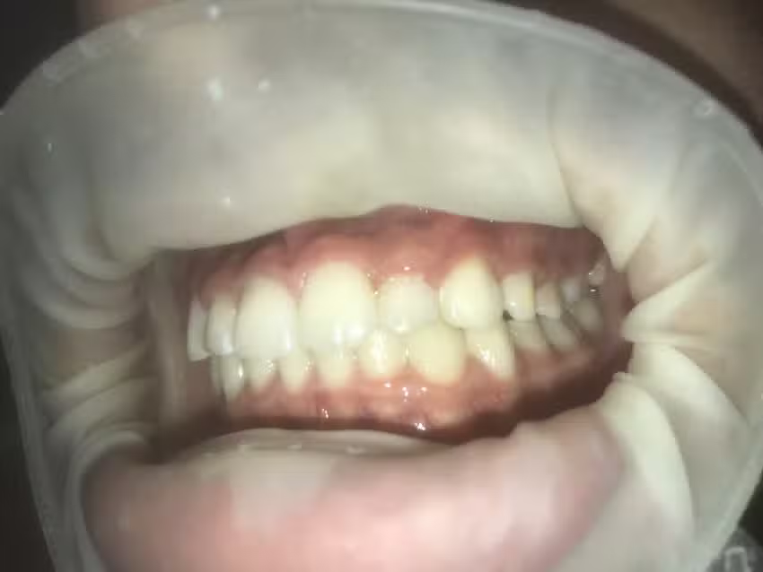 Noelia Acosta-Ortodoncia Morteros