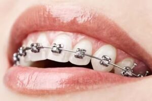 Od. Maria Julia Azcona