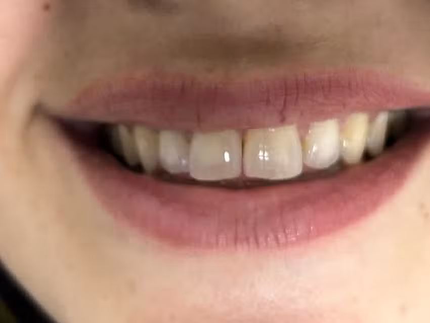 Odonto BIC Dental Healt