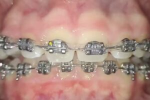 Odont&oacute;loga Luciana Beckmann