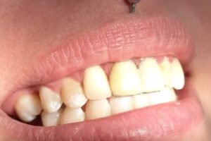 Odontóloga Nicollier Tapia Ivonne Unquillo