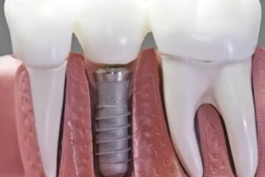 ODONTOLOGÍA BANFIELD LARROQUE 1007