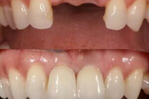 Odontolog&iacute;a Castor &ndash; Larrion