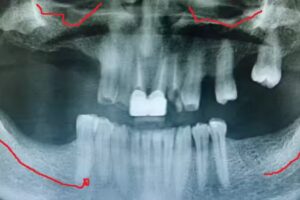 Odontologia Del Cabildo Ni&ntilde;os y Adultos